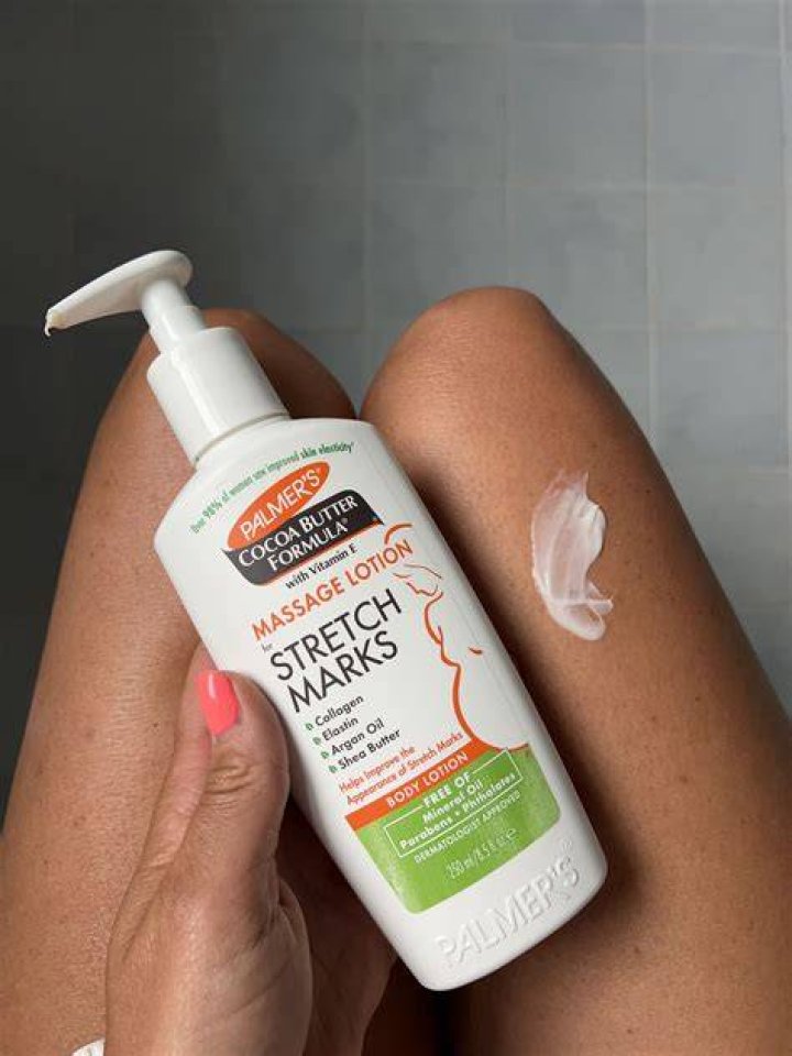 8 best stretch mark creams that actually work, per experts