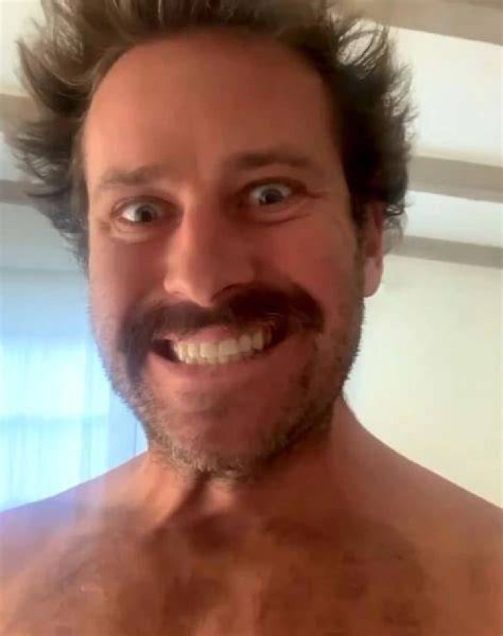 Armie Hammer sex assault allegations being reviewed by LA DA