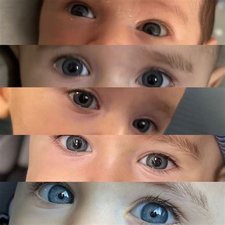 Baby's brown eyes turn blue overnight after COVID-19 treatment