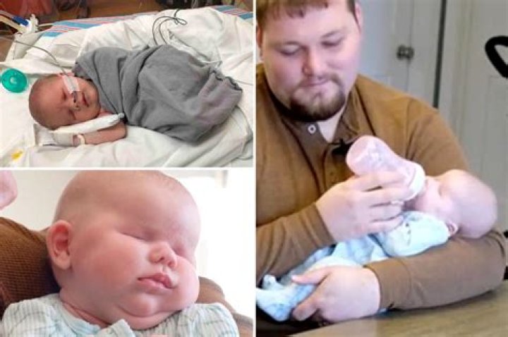 Baby born without eyes due to rare genetic disorder