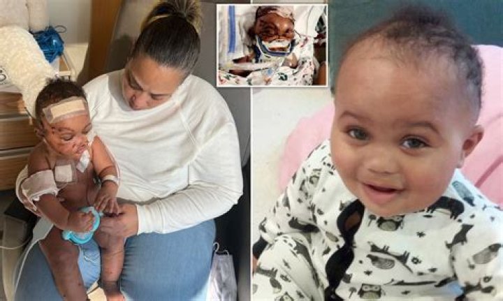Baby loses 5 fingers in dog attack, mom faces neglect charge