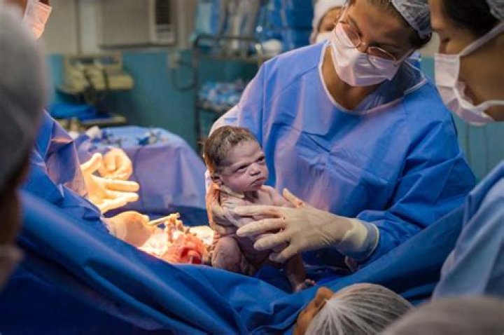 Brazilian baby goes viral for epic scowl moments after birth