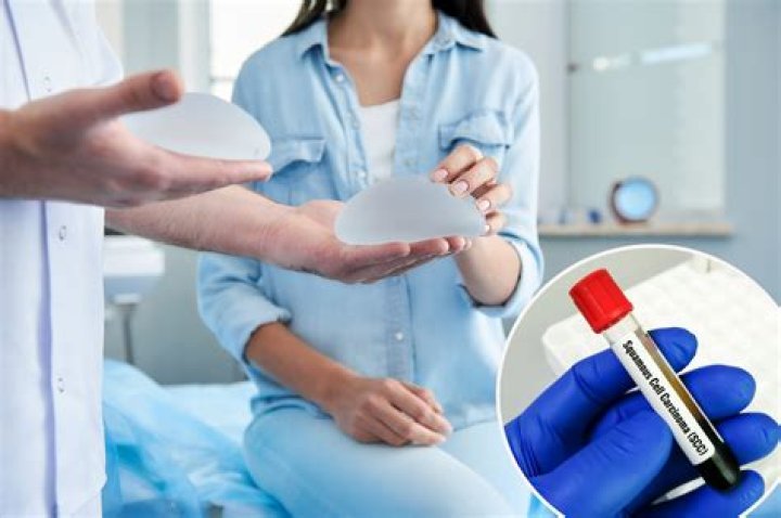 Breast implants can lead to skin cancer, FDA warns in alarming report