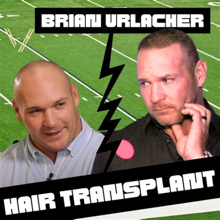 Brian Urlacher sues hair transplant company over 'deceptive' post