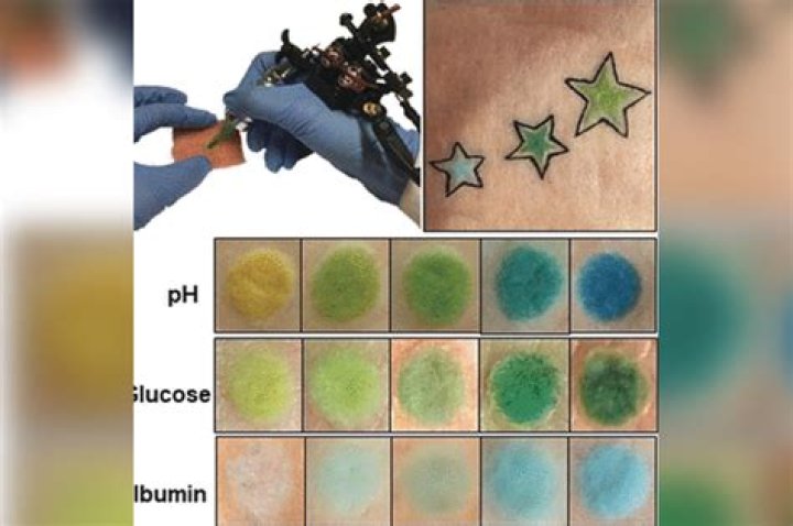 Color-changing tattoos will track your glucose levels: study