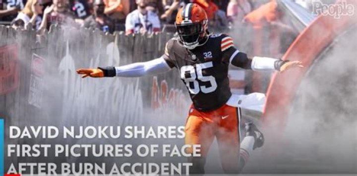 David Njoku burned '17-to-18 percent' of his body in firepit accident