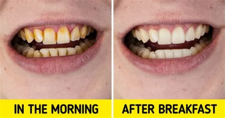 Dentist reveals why it’s dangerous to brush teeth after breakfast
