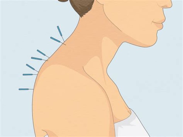 I cracked my own neck to save money — now I'm blind