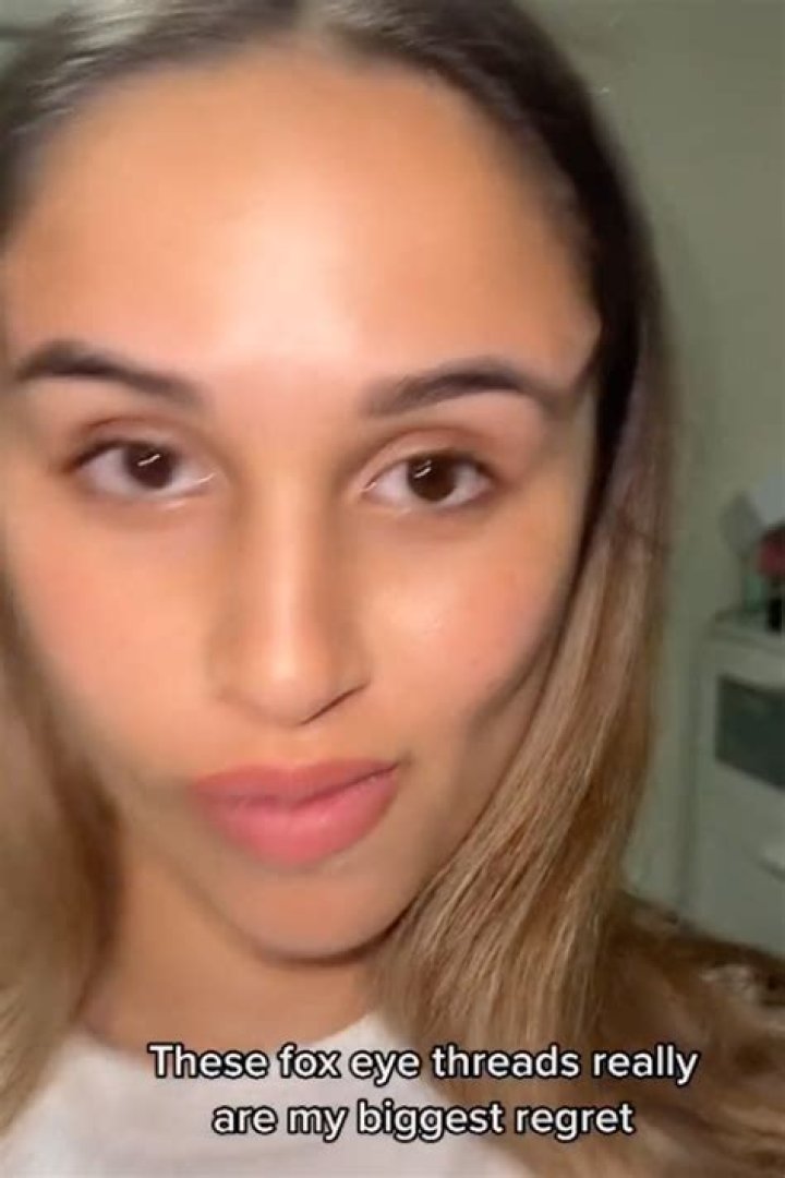 I got fox eye surgery but it’s my biggest regret ever
