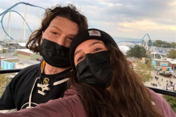 I’m in love with a face transplant survivor — now I’m a punching bag for trolls