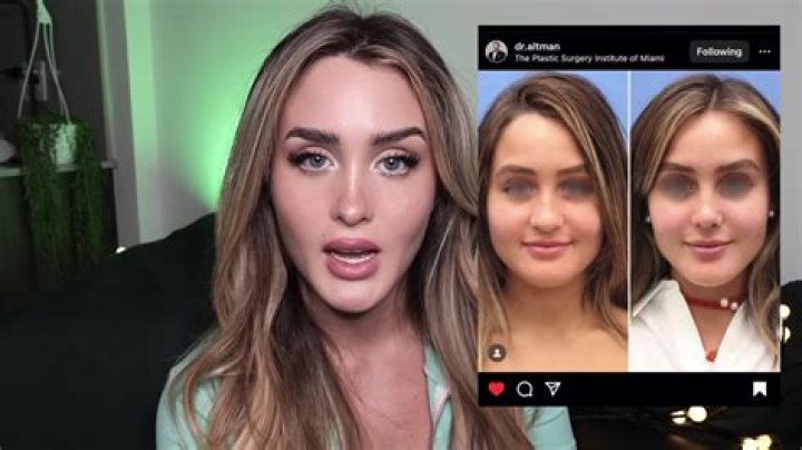 I was so ugly I bought a new face for over $30K