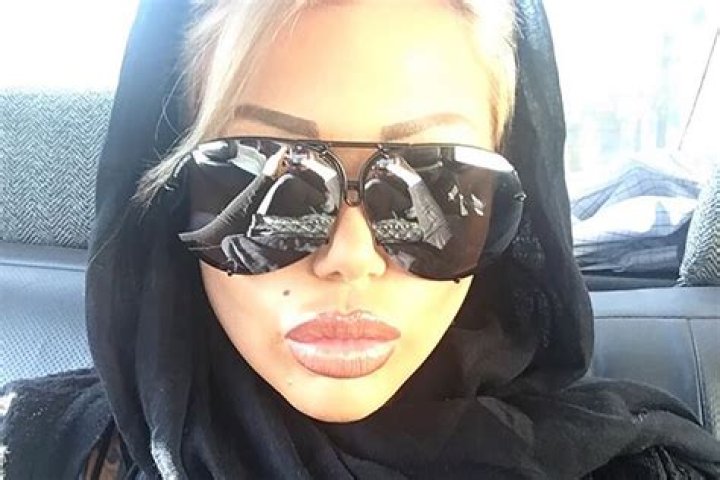 Iranians outraged after porn star visits for nose job