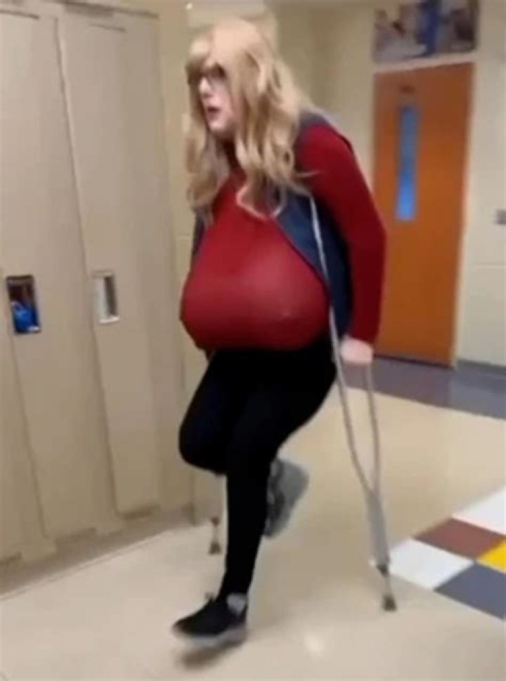 Kayla Lemieux, Canadian teacher with size-Z prosthetic breasts, on paid leave