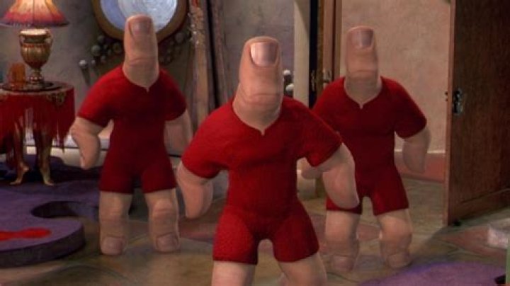 Man's big thumb is the world's freakiest finger