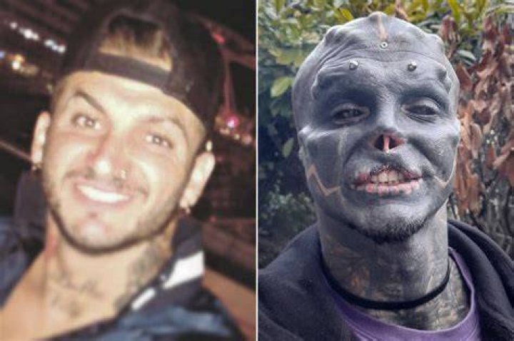 Man turns himself into 'black alien' by removing nose, top lip