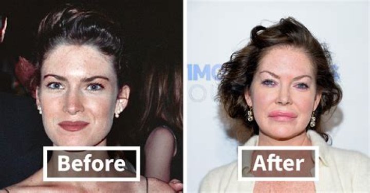 Meg Ryan 'a mess' after botched 'facelift': celeb plastic surgeon