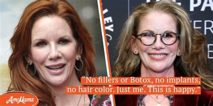 Melissa Gilbert says Botox left her looking like the 'spawn of Satan'