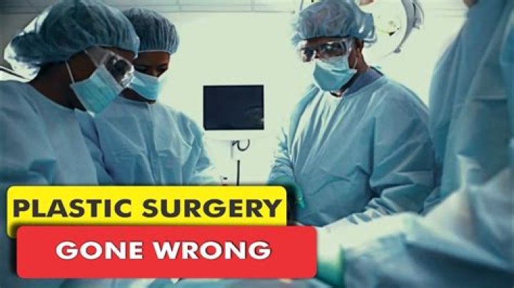 Mom died, was resuscitated during botched BBL surgery