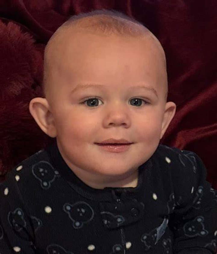 Mum blasts daycare after baby’s face scratched 20 times