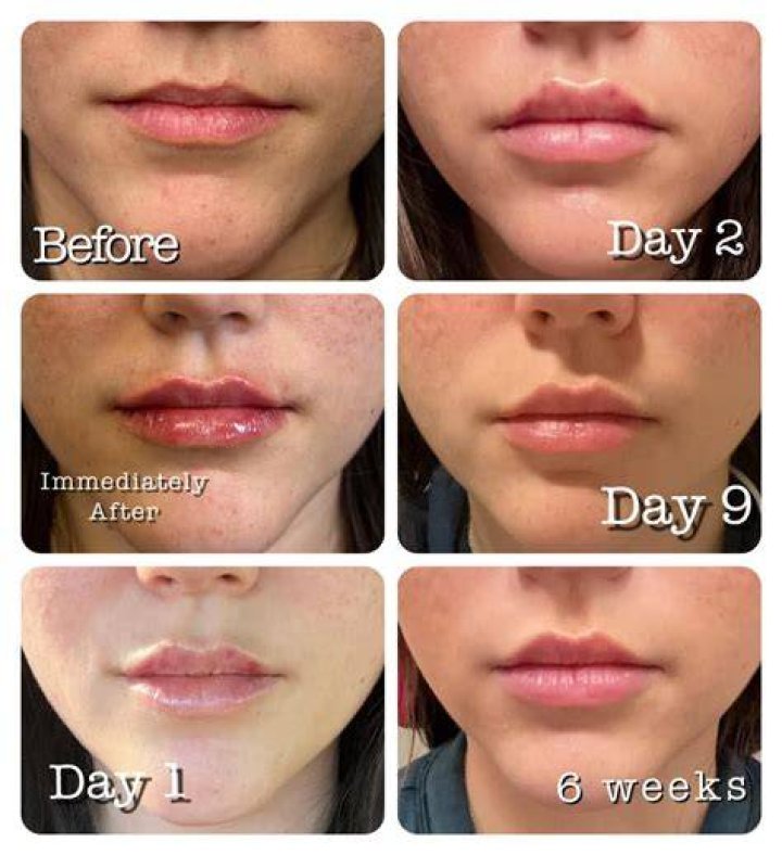 My entire top lip was ripped off by a Pitbull — here's what I've learned about beauty