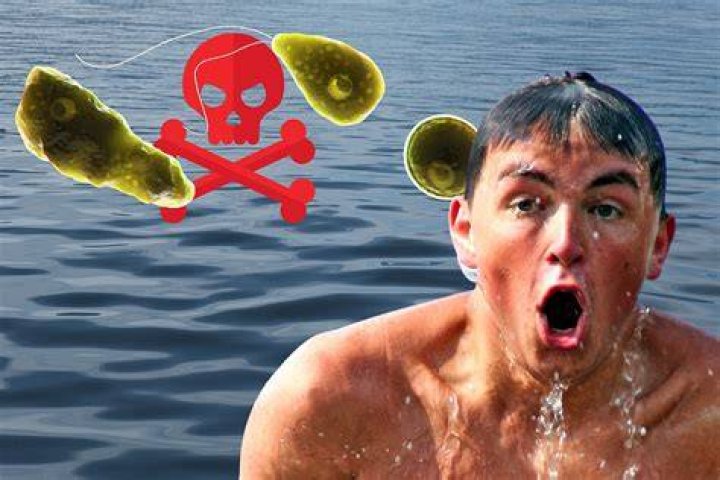 New Jersey surfer dies from deadly 'brain-eating amoeba'
