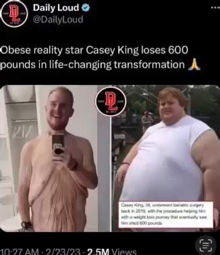 Obese reality star Casey King loses 600 pounds in life-changing transformation