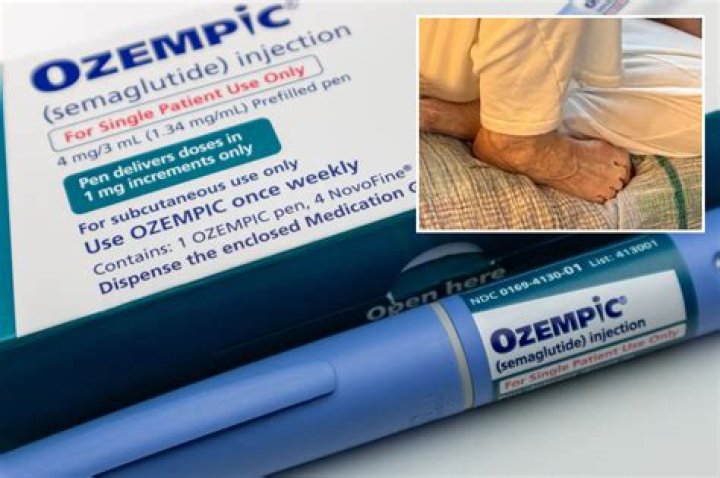 Ozempic users spark spike in ER visits: Shocking new side effects