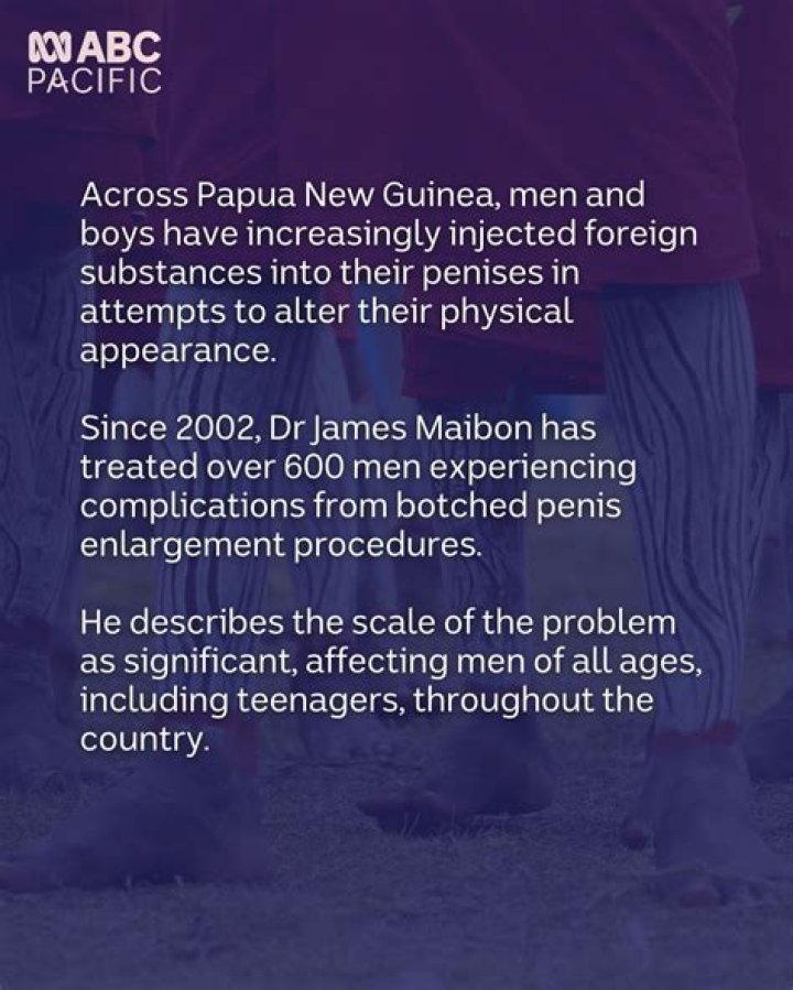 Penises as 'outies,' clitorises as 'd--klets'