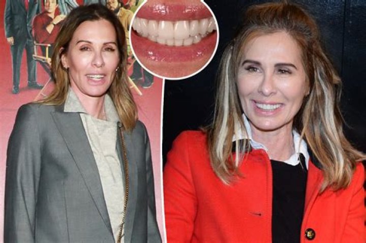 RHONY Carole Radziwill gets $110K smile makeover – New York Post