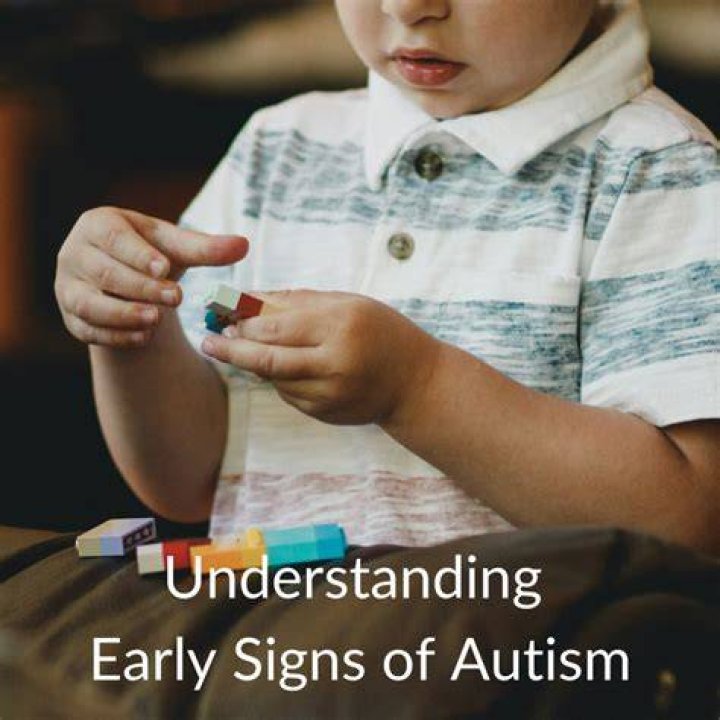 Routine ultrasound 'can identify early signs of autism': study