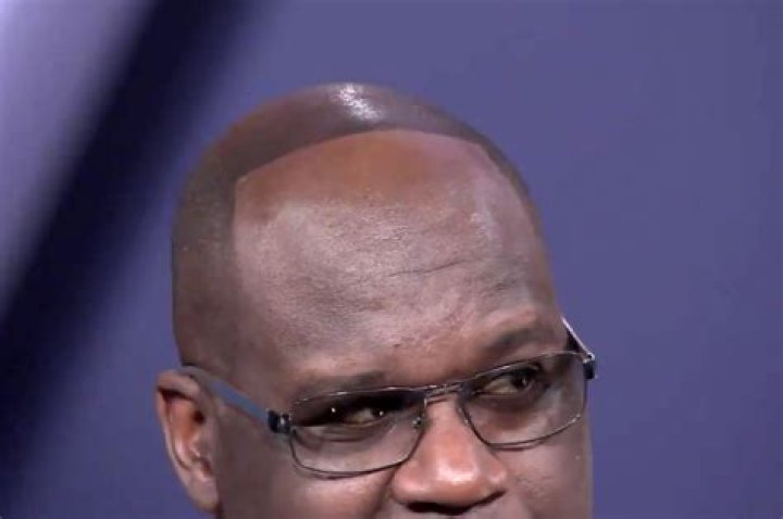 Shaq reveals receding hairline after losing bet to Dwyane Wade