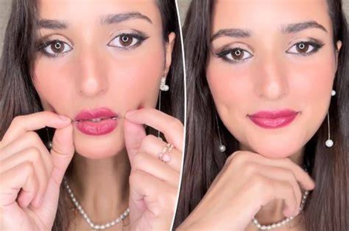 Smiling influencers love the ‘dimple maker’ — but it could cause permanent damage
