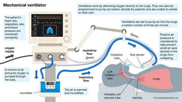 Tesla-made ventilators won’t arrive in time for coronavirus apex in New York