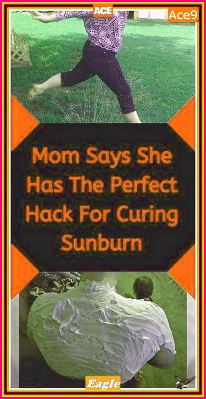 This mom’s ‘miracle’ sunburn hack might actually work