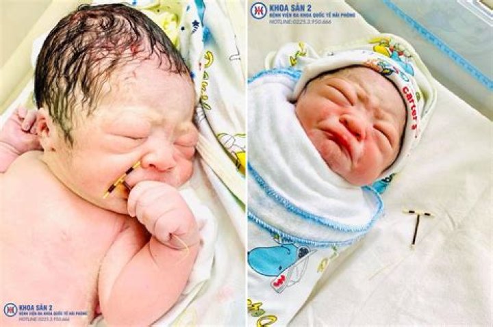 Unstoppable newborn poses with IUD that failed his mom