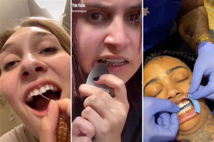 Viral TikTok reveals dentists can tell if you've been naughty