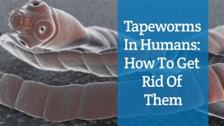 Watch this video of a 32-foot tapeworm at your own risk