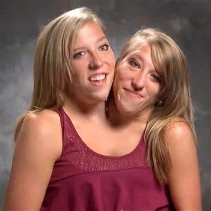 We're conjoined twins — I'm asexual, but my sister is dating