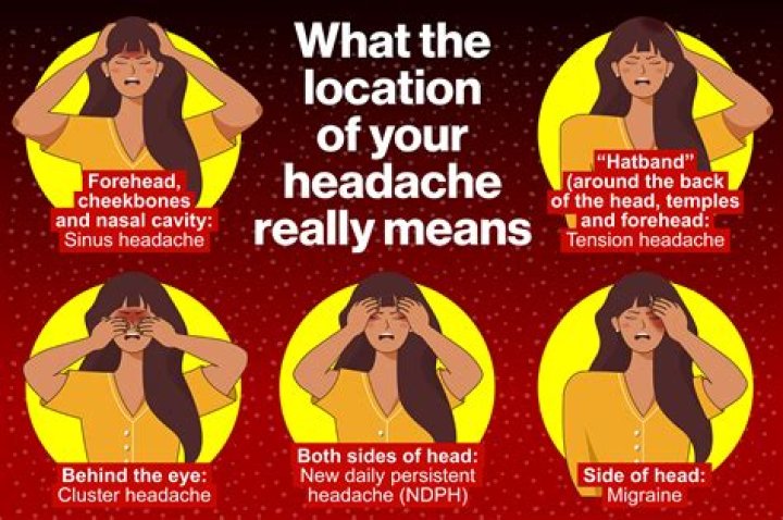 Why do you have a certain type of headache? Location is key