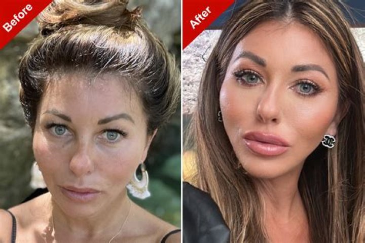 Woman dies after cosmetic surgery by dubious doc